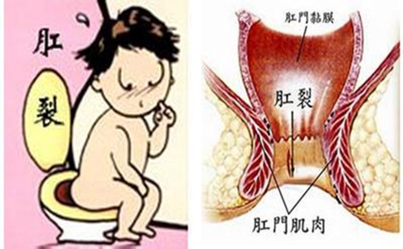 南宁肛肠医院：构建健康守门员