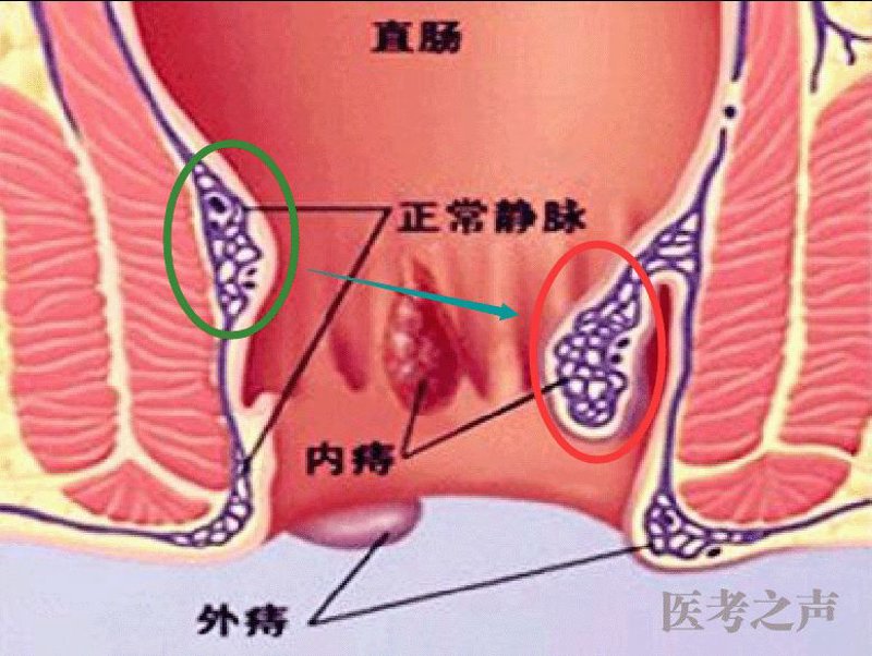 南宁肛肠医院：构建健康守门员